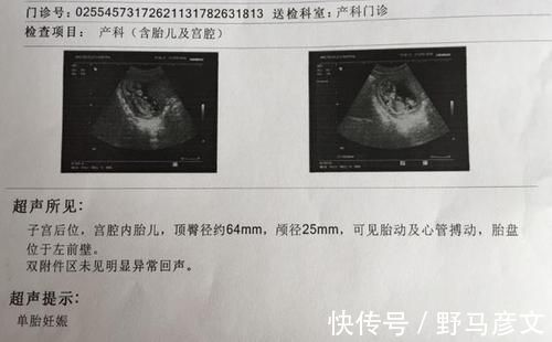 避孕|29岁孕妇上厕所一尸两命，除了羊水栓塞，它是孕妇更大的绊脚石