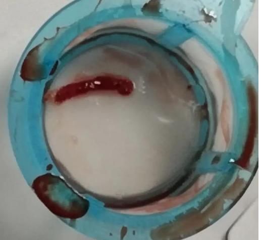 医生|丹参片能不能长期服清理血管垃圾?看完医生这篇文章就知道了