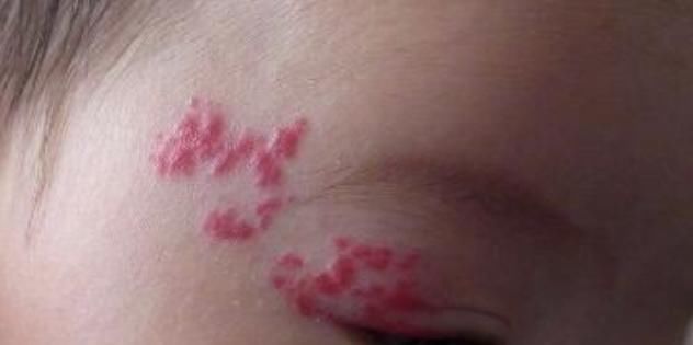 有毒物质|怀孕后，这4件影响宝贝“颜值”的事孕妈最好别做，特别是第一件