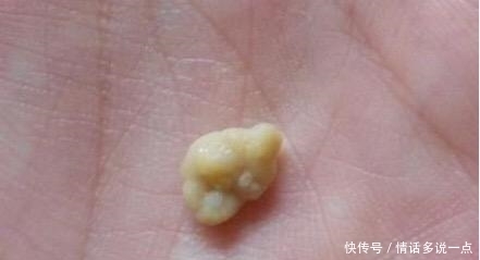 妈妈|小男孩因异味被孤立,医生捂鼻检查后,让妈妈自责不已