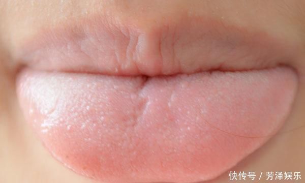 预警|吃饭时,总咬到舌头或腮帮子并不是馋肉了,或是大脑发出的预警