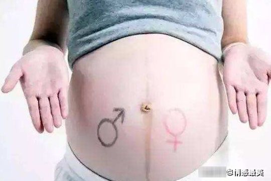 小萍|怀孕时,孕妇肚子上出现的“线”是什么?和胎儿的性别有关吗?