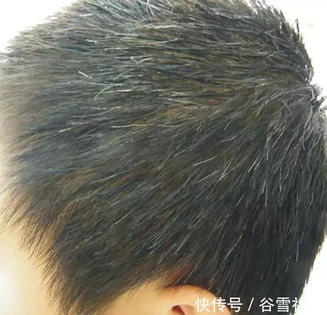 老中医|老中医公布护发秘方,100天9种食材,脱发白发头油头皮屑统统搞定