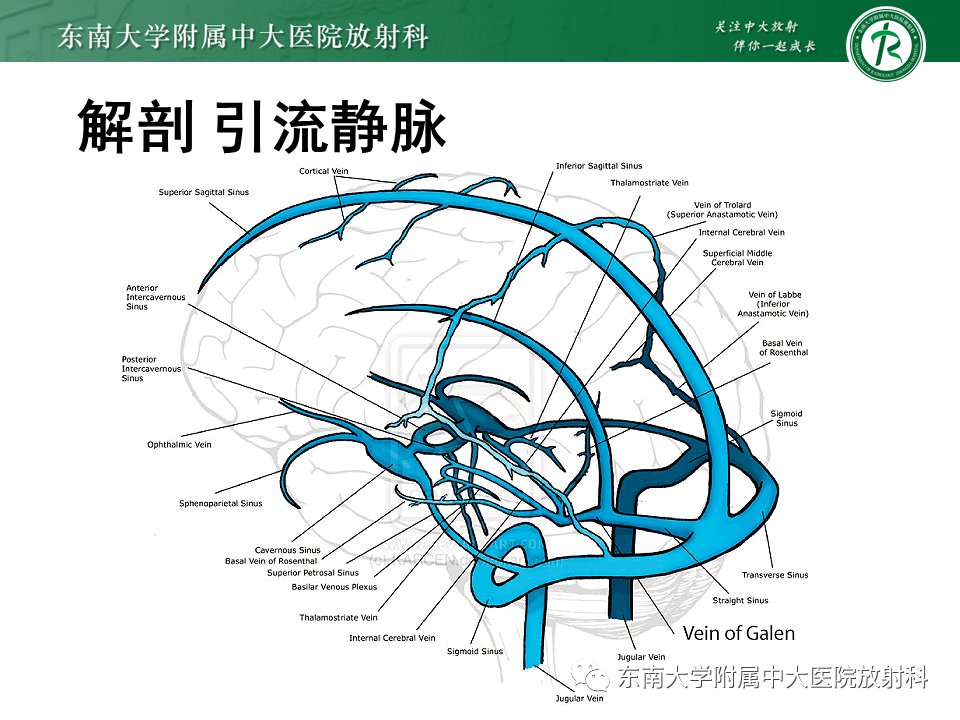 脑动静脉畸形 影像表现