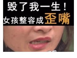 皮肤|为变美做“脂肪填充”的女人，如今变啥样了？过来人：还不如不做