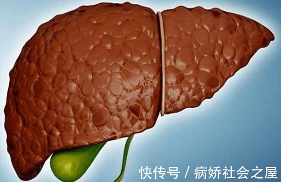 养肝|40岁以后身体有这5个现象,或是肝脏在向你呼救,再不重视就迟了