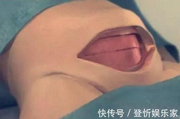 伤口|剖腹产只是“挨一刀”就完事看完手术全过程,忍不住心疼女人