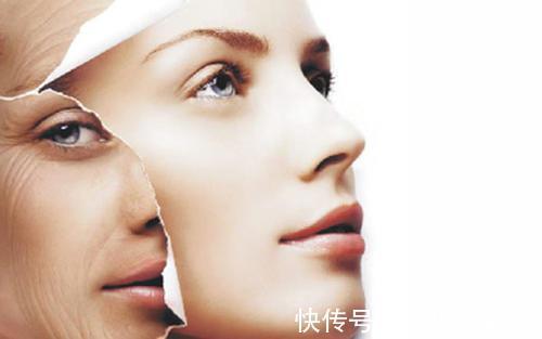 下垂|王小民教授:30岁以后如何改善面部松弛下垂