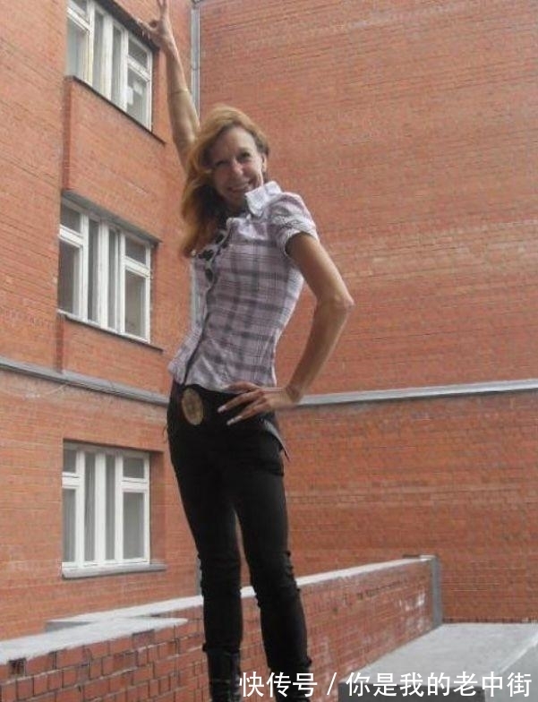 奇迹|刚出生的婴儿满脸皱纹,医生说活不到1岁,21年后奇迹发生了