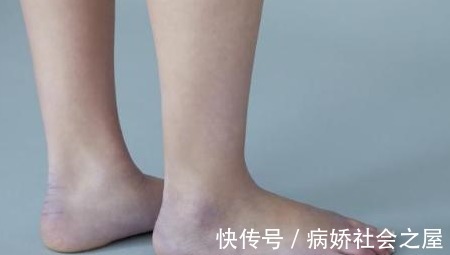 身体|身体的4个警告是在告诉你，肝不舒服！养肝少吃“3甜多吃3苦”