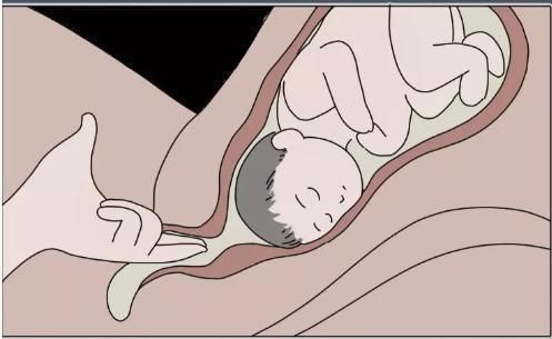 过程|顺产“开十指”是怎么开的一组过程图让你明白什么叫为母则刚