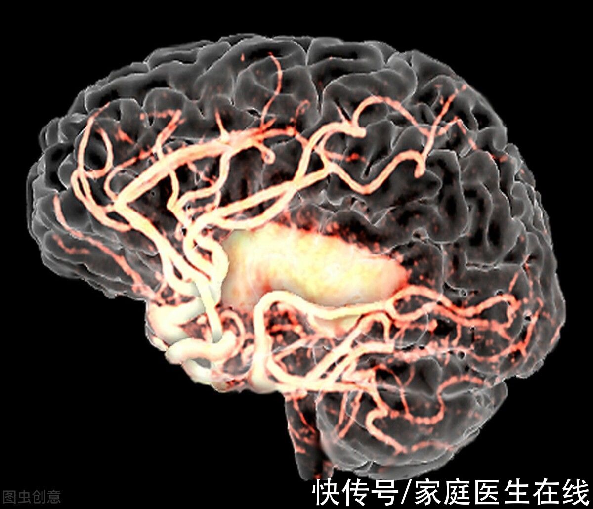 预防|高血压和脑卒中关系“暧昧”？有关系，预防从4个方面入手