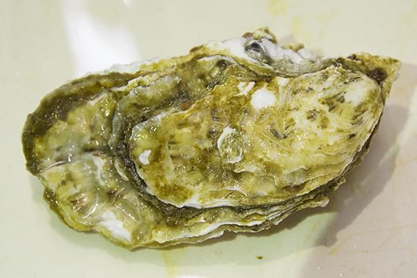 甲状腺疾病是海鲜吃多了引起的吗?专家告诉你,具体病因是什么