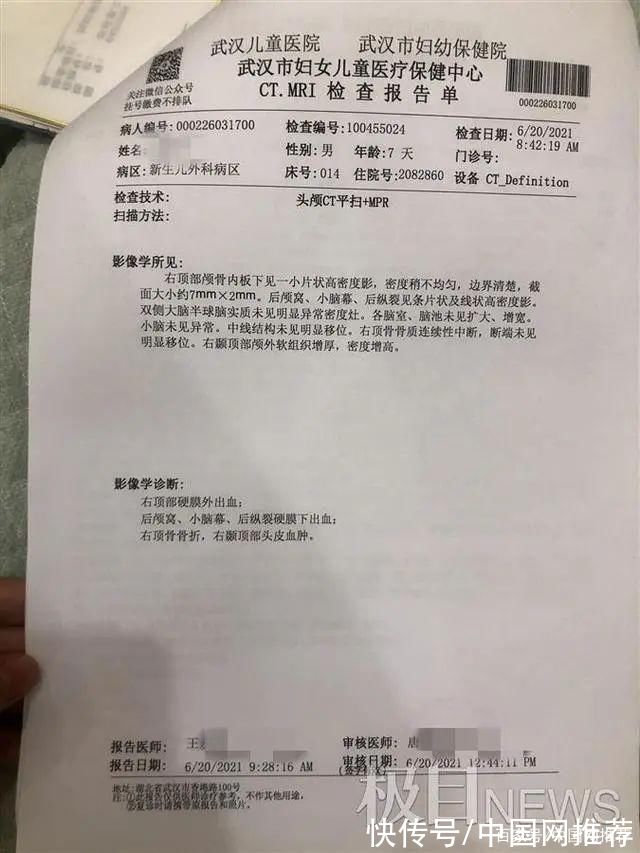 宝宝|痛心!因月嫂打瞌睡，出生6天的宝宝被摔成颅骨骨折