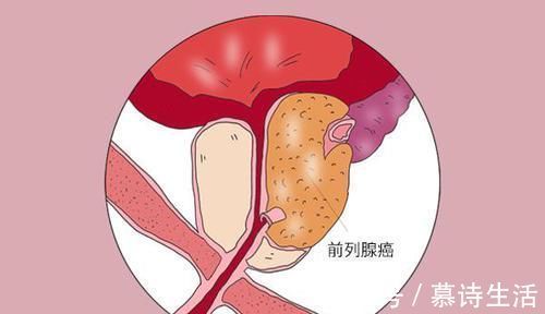 锻炼身体|98岁的季羡林,患2种癌,依旧高寿,专家他的秘诀很多人做不到