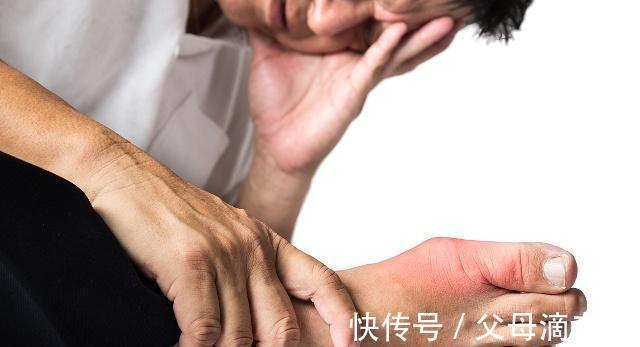 嘌呤含量|尿酸高痛风,不喝一种汤,可喝一种饮品