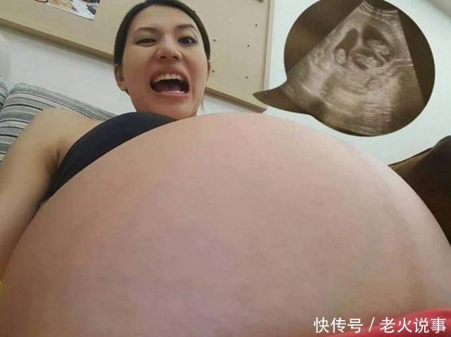 女子喜怀二胎肚子很大，去医院把孩子产下后，全家就愁了!