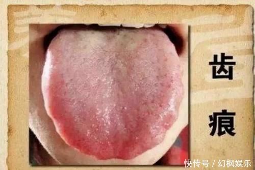 人到中年,身体2处越“大”,湿气越重,寿命越短,越早知越好