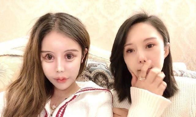 双眼皮|16岁女生整容60次花费过百万割双眼皮、隆鼻、磨骨变做人形芭比