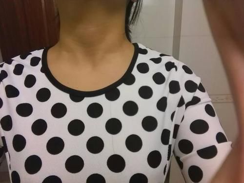 包块|癌症早期有什么症状?如何才能早发现?