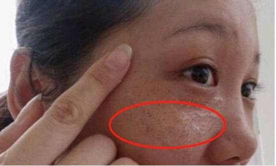 山药|中医明说脾胃不好,全写在脸上,多吃3种食物,脾脏强壮健康