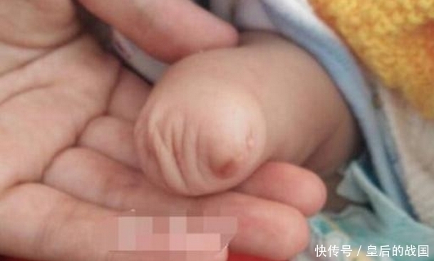 a3427|刚出生婴儿只有一支手臂,医生难以相信,知道真相,产妇泪奔