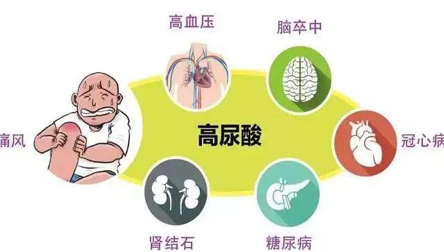  就下|48岁男子，尿酸高达860，入院就下了病危，提醒：2件事害人不浅