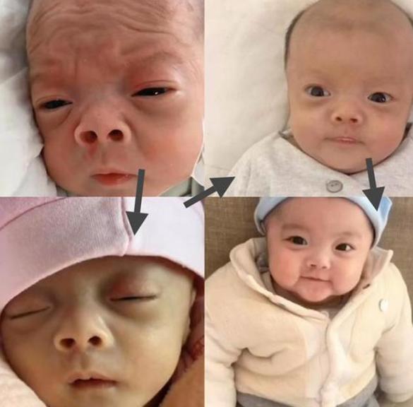 浮肿|“丑哭宝妈”的网红宝宝逆袭成功,被嫌弃长大,如今美得判若俩娃