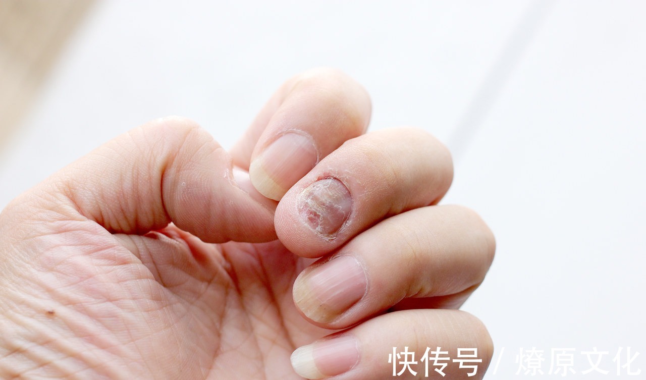 对症治疗|6种症状别“硬抗”,超过一定时间不愈可能是癌,建议及时就医