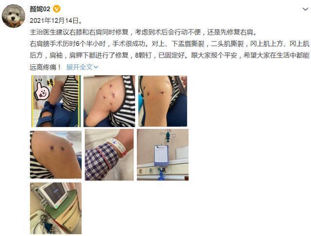 女排精神|34岁女排老将晒手术照!右肩打8颗钢钉,伤口触目惊心,球迷泪目