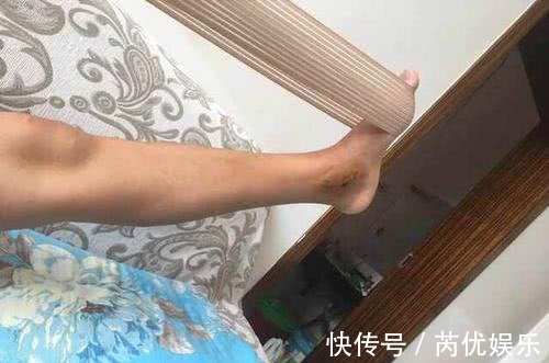 营养物质|骨科医生不想骨头又脆又软,常吃3物,做1事,到老不骨质疏松!