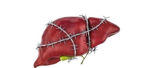 被胃癌“喜欢”的人，一般都有这5个特点！希望你没有