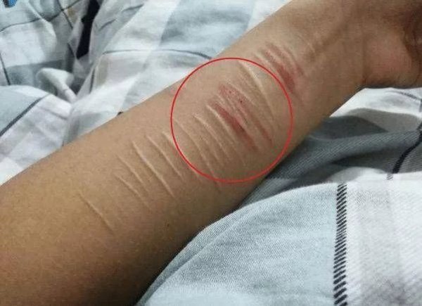 孩子|孩子如果出现这3种“情况”,说明可能心理有问题了,父母要重视