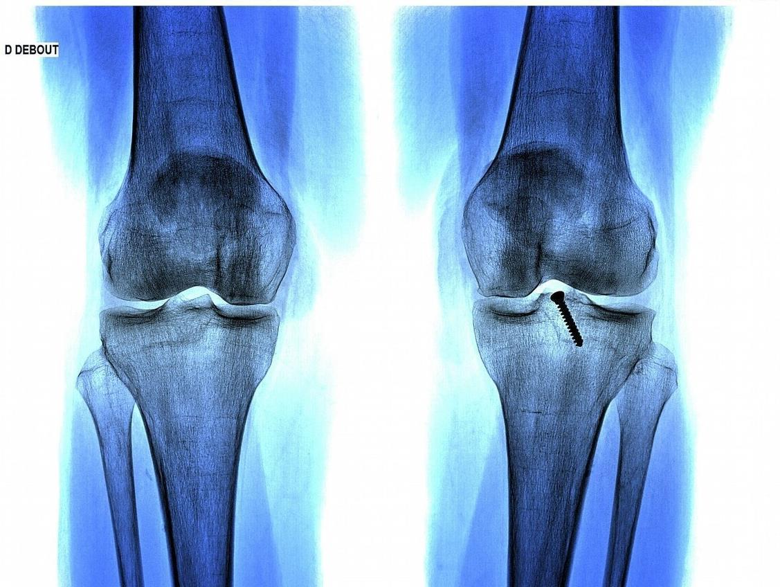 生长发育|12岁男孩身高“不长反降”,医生:年龄这么小,一事怎能天天做