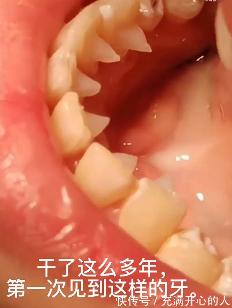 |今日段子:离职的一百种原因之一!竟然是因为大便!