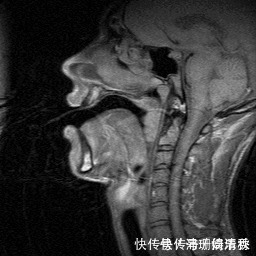 家长|宝宝很聪明,就是说话晚、说不清?讲真,“元凶”可能是家长