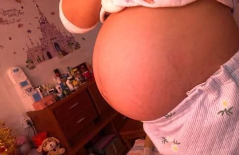 炎症|夺走多个胎儿的“伤胎凶手”,就在孕妇身边,快看你有没