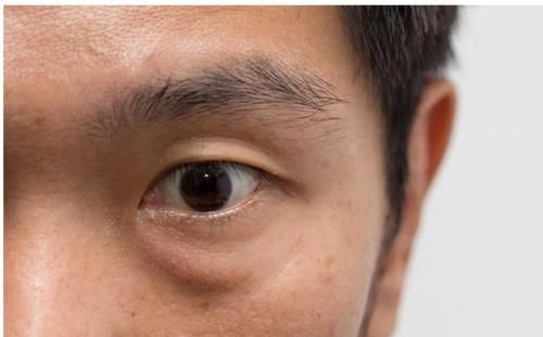 眼袋|男性老不老，看“早上起床”的表现就知道？别羞于查看