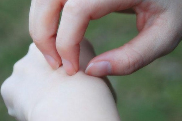 疹子|手部出现四大变化，有可能是血糖过高，不占说明血糖还稳定