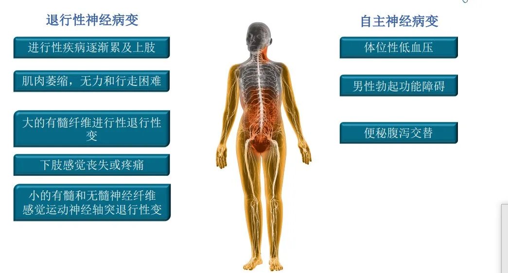 淀粉人|70岁大妈被诊断为“淀粉人”，家族中数人罹患，全球患者不超过5万例