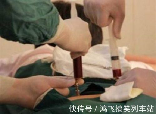 家长们|脐带血=救命血?伴随孩子降生的这份“礼物”,到底要不要留存?