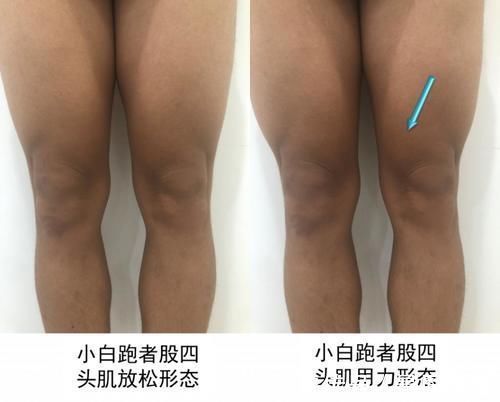 股四头肌|坚持跑步给你留下训练痕迹了吗?跑者的十大形态特征