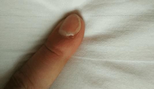 肝脏|身体这个“部位”断裂,说明你的肝脏病变了,不要大意