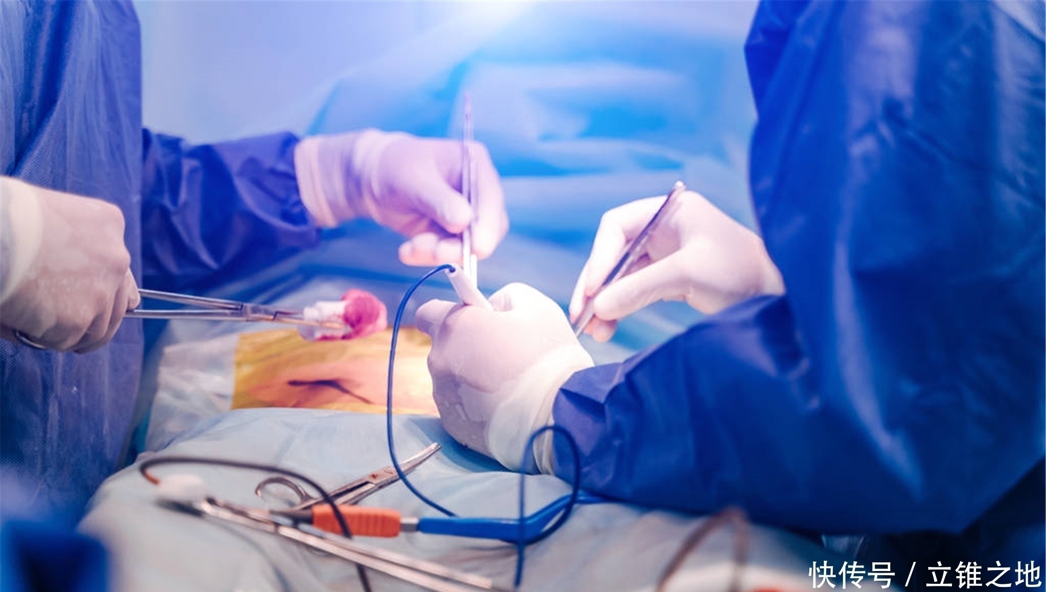 癌细胞|已经手术了,为什么肿瘤还会复发?分析了3种原因,得重视起来