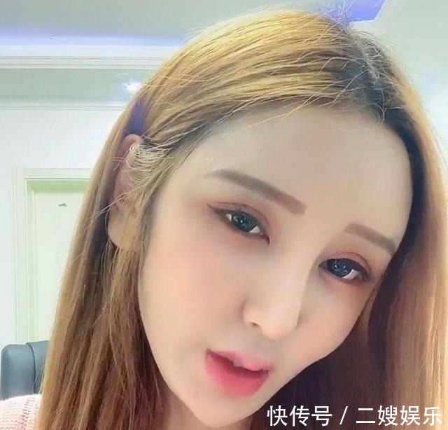 东北女孩 8年的整形手术花费了100多万,光额头就打了200多支玻尿酸