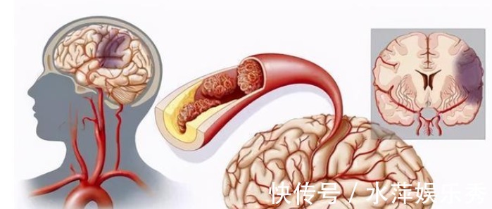 中老年人|丹参和山楂这样吃,疏通血管,活血化瘀,有助缓解心脑血管疾病!