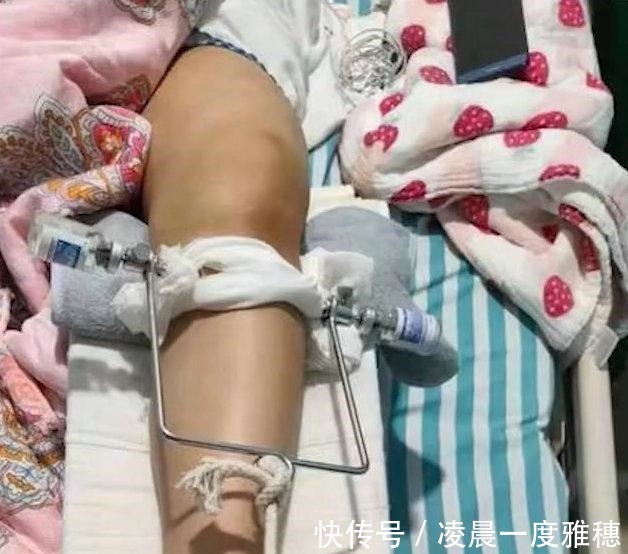 瑜伽|女子练瑜伽被教练压断大腿!网友下手太狠了!