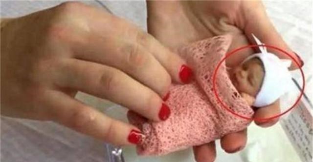 拇指姑娘|童话里的“拇指姑娘”走进现实,一出生仅25厘米,如今美出泡儿