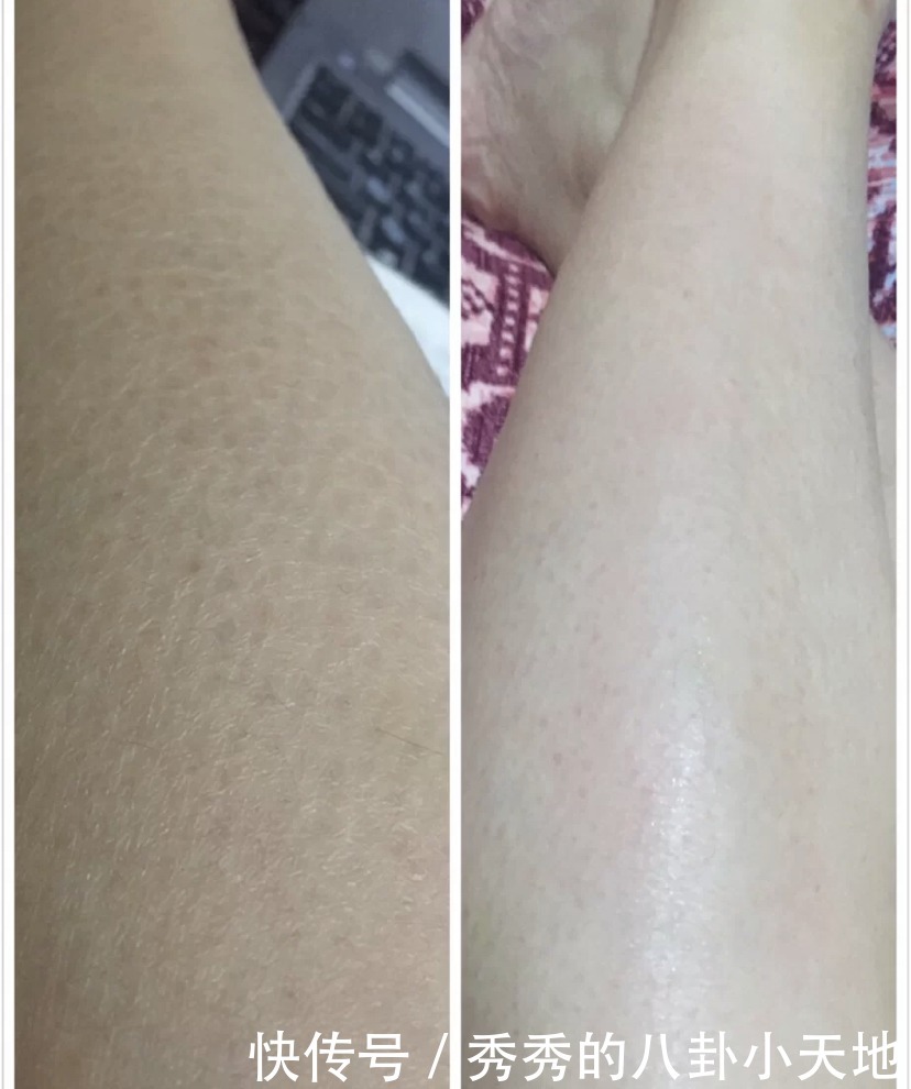 三部曲|精致女人的三部曲:护理好头发、皮肤和眼睛,轻松提升颜值