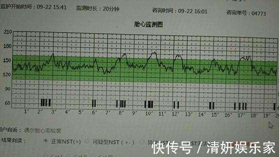 指南|十月怀胎要做多少次产检每次查些啥注意啥准备啥最全指南